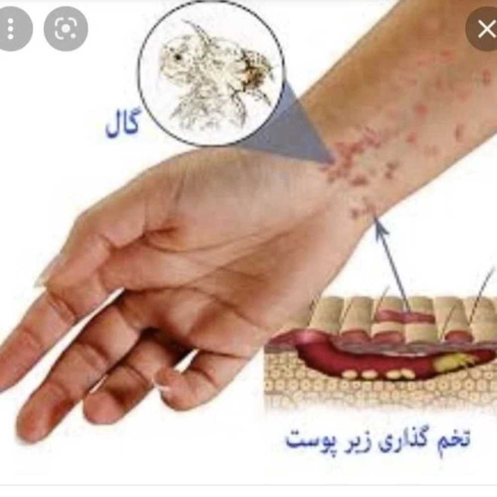 1760441770465.webp